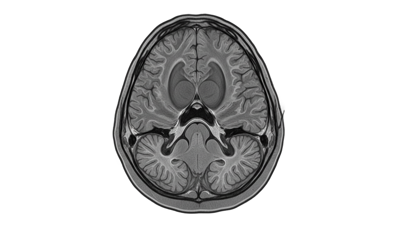brain mri png PNG transparent background