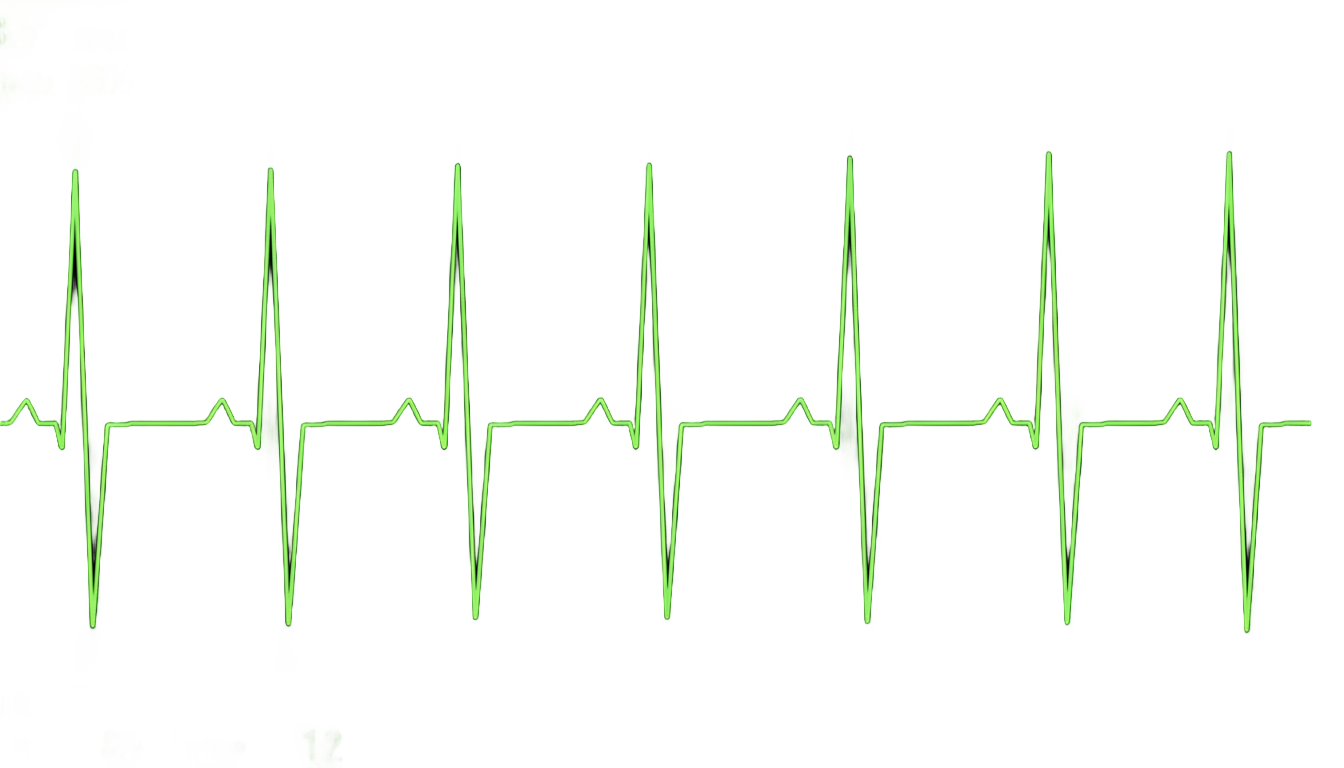 heartbeat monitor png PNG transparent background